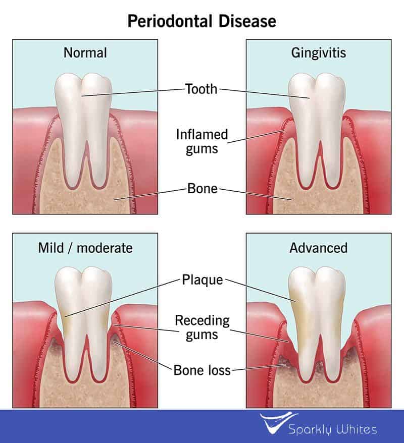 If Your Gums Could Talk, What Would They Say About Your Health Wolverhampton?