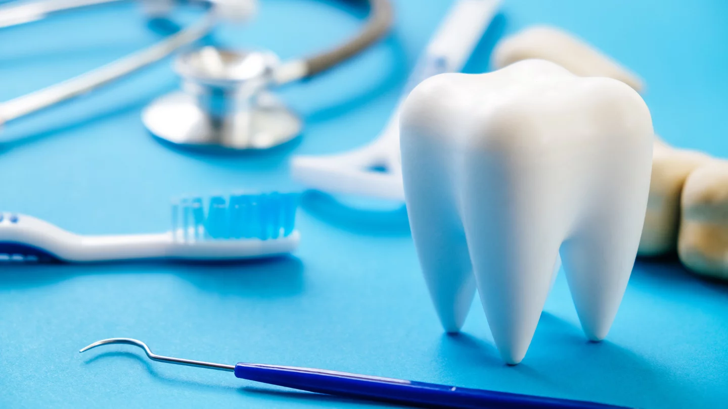 How Often Do You Need Teeth Whitening in Wolverhampton, UK?