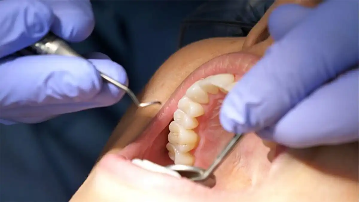 What's The Actual Difference Between Laser and Tray Teeth Whitening—And Why Should You Give a Floss Wolverhampton?